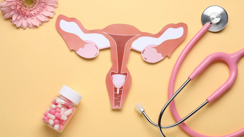 PCOS name change to PMOS at a fertility clinic in MS & LA