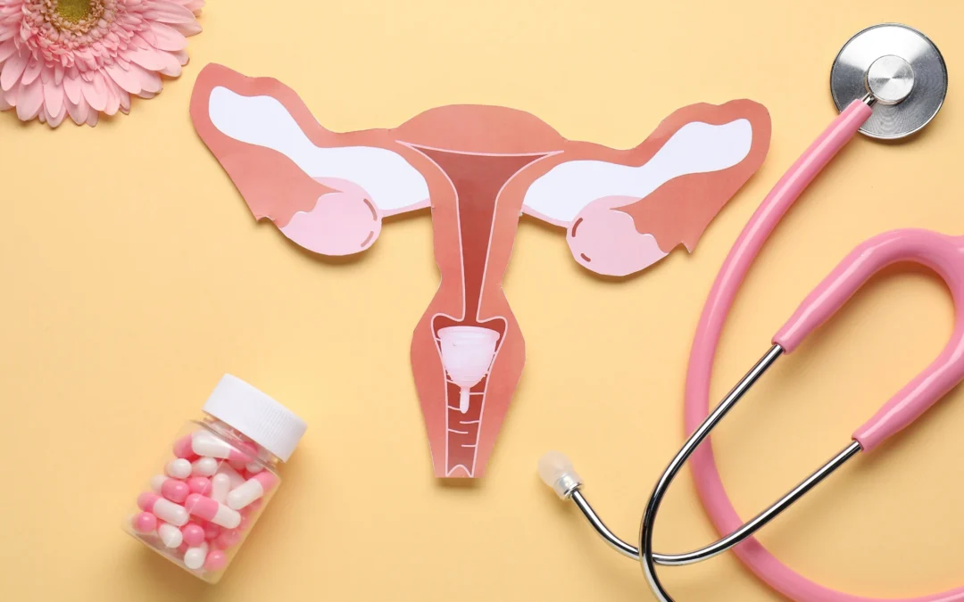 PCOS name change to PMOS at a fertility clinic in MS & LA