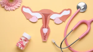 PCOS name change to PMOS at a fertility clinic in MS & LA